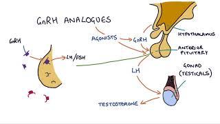 How do GnRH analogues work? Zoladex, Prostap and other GnRH analogues