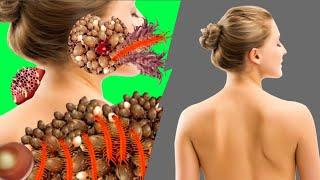 Asmr back treatment animation maggot removal worm remove dog tick remove treatment animation video