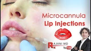 Larger Lips Tutorial Microcannula Filler Technique-Dr Rajani