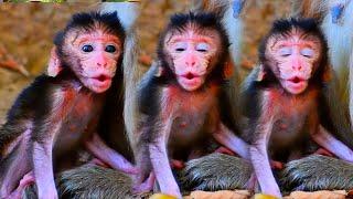 Cutest Tiny Baby Monkey Really Wishes To Walk Well Soon | Serene Natural Wildlife