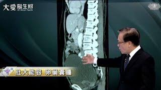 【大愛醫生館】肚大能容 卵巢囊腫 20230201