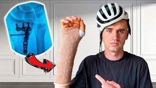 I fell off my Bike and broke my Wrist