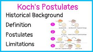 Koch's Postulates | Historical Background | Definition | Postulates | Limitations |