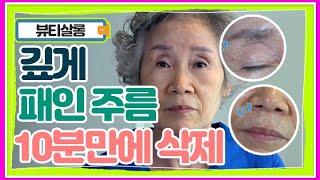 이마주름/눈가주름/팔자주름 우리 얼굴에 있는 모든 주름 10분만 투자하면 지울 수 있다?! MBN 210803 방송