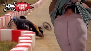 ALL of Guy's EPIC crashes and gruesome injuries | Guy Martin Proper