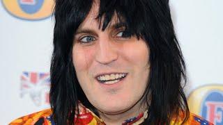 The Untold Truth Of Noel Fielding