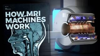 The Insane Engineering of MRI Machines