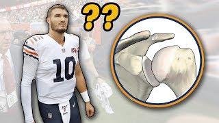 Doctor Reviews Mitch Trubisky Shoulder Injury and Shoulder Dislocations