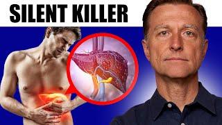 Silent Killer: Identifying Liver Cirrhosis Before It's Too Late