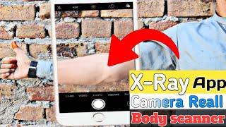 x - Ray camera body scanner app real | Live proof