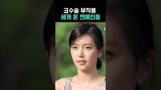 코 성형 부작용