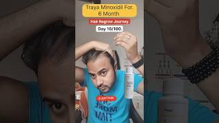 Day 16/180 Hair Regrow journey with Traya Minoxidil  #minoxidil #traya #hairregrowth