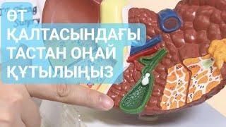 Өт қалтасына тас байлану ауруы (желчные камни) және оны емдеу мен алдын алу шаралары