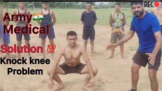 Knock knee exercises | Knock Knee Problem in Hindi | Defence Academy
