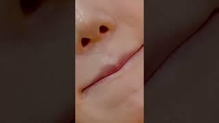[닥터쁘띠] 반짝반짝 체리같은 입술을 원한다면? 입술필러. #shorts #입술필러 #피부과 #필러후기 #필러 #일산  #beauty #피부관리 #kbeauty