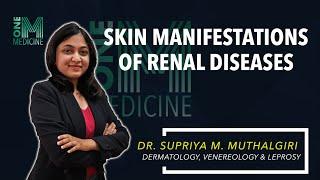 Chapter 50 | Skin Manifestations of Renal Diseases | Dermatology | OneMedicine