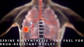 Serine Biosynthesis: Mediating Drug-Resistance in NSCLC?