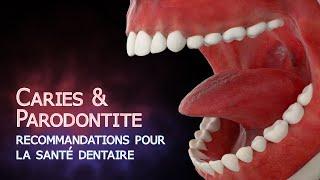 Prévenir les caries et la parodontite (Animation)