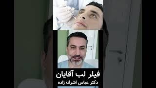 Lip Filler For Mens ! Mens Lip Filler By Dr.abbas Ashrafzadeh