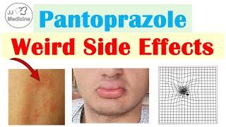 Pantoprazole Weird Side Effects (Skin, Infections, Nutrient Deficiencies) & Why They Occur