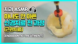 [Dentistry ASMR] Revealing the whole process of the root canal treatment! |While You're Saying Ahhh