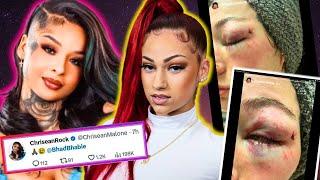 Glorification of Domestic Abuse Online by Influencers:Bhad Bhabie posts video of her domestic abuse