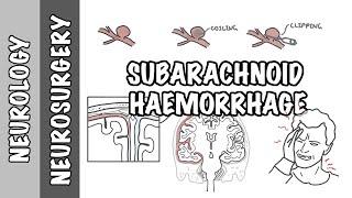 Subarachnoid Haemorrhage / pathophysiology, complications and management