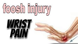 FOOSH - Fall on Outstretch hand (Wrist Pain) Part 1 | House Physiotherapy