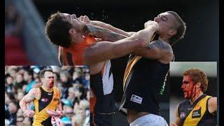 Biggest AFL Fights and Brawls