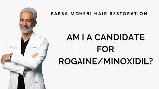 Are you a Candidate for Rogaine/Minoxidil? (Answered by Dr. Parsa Mohebi)