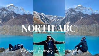 North Abc Vlog | Ep - 2