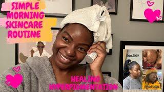 Morning Skincare Routine | AFFORDABLE Skincare | Treating Angular Cheilitis Pt. 1 | This Is Fenique