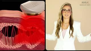 Renelif Advanced Light Therapy Device | Anti-Aging LED Skin Rejuvenation