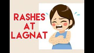 Rashes with Fever - by Doc Liza Ong # 283