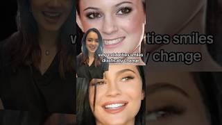 WHY CELEBRITIES TEETH DRASTICALLY CHANGE #shorts #transformation #dentist #dental #glowup #veneers