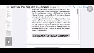 Antepartum hemorrhage mrcog-1