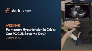 Pulmonary Hypertension in Crisis: Can POCUS Save the Day?