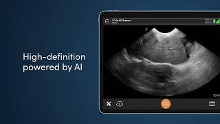 High-Definition Wireless Ultrasound Specialized for Veterinarians!