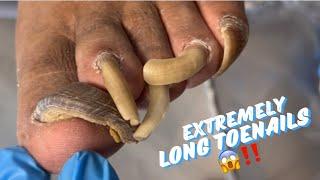 EXTREMELY THICK AND LONG TOENAILS!  + PEDICURE