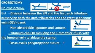 What surgical techniques tactics are needed  CHIVA Franceschi