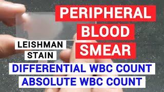 PERIPHERAL BLOOD SMEAR | HAEMATOLOGY LAB | PHYSIOLOGY PRACTICALS