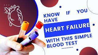 NT pro BNP blood test | Blood test for heart failure | BNP vs NT pro BNP