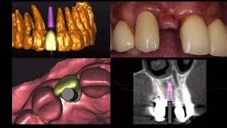 Dental Surgery Preparation at Healthy Smiles