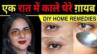 Dark Circles Under Eyes Home Remedy | Dark Circle Kaise Hataye| आंखों के काले घेरे कैसे ठीक करें