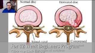 How to Strengthen your Back against Disc Herniation Part 1