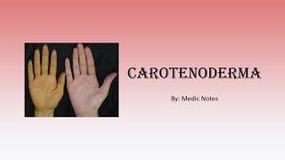 Carotenoderma - orange skin, causes and pathophysiology