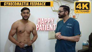 My Gynecomastia result after 3 months. Patient feedback #subtitles