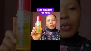 Dermaliss Cleanser Review, best face cleanser for acne, pimples and oily skin #skinspots #acnefree