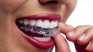 Best Invisalign Dentist in Woodland Hills!