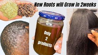 CLOVES $ ROSEMARY WATER FOR FAST HAIR GROWTH.